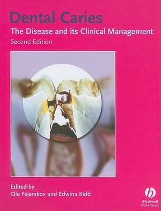 Dental Caries — boekomslag