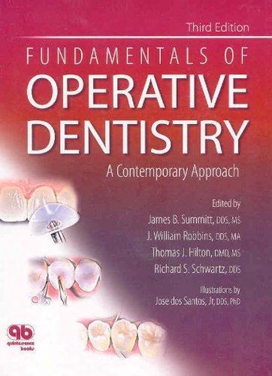 Fundamentals of Operative Dentistry — boekomslag